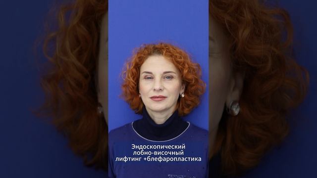 Результаты до и после комплексной лифтинг-операции в Институте на Трубной