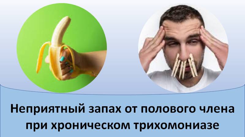 Запах от полового члена при хроническом трихомониазе