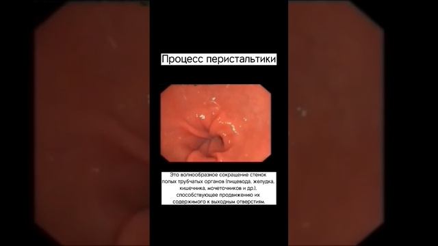 Стимулируют перистальтику благодаря обилию растительных пищевых волокон. #кишечник #перистальтика