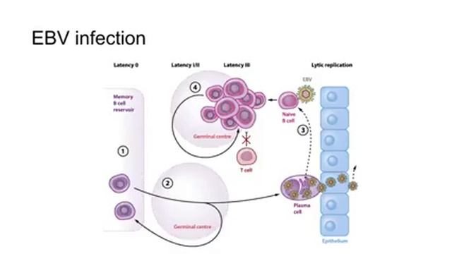 Lecture 4-2: Infections; BK and EBV infection