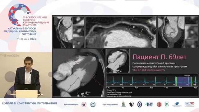 Протоколы сканирования в интенсивной кардиологии Ковалев К.В.