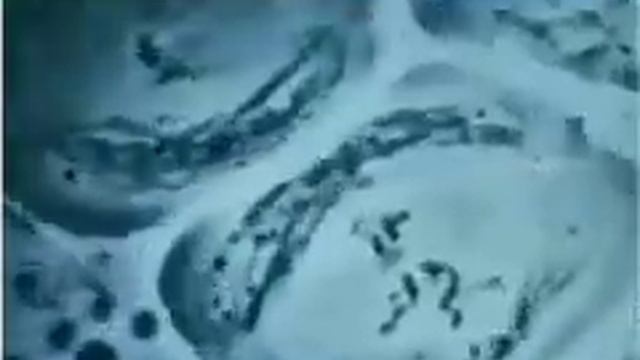 meiosis under microscope