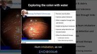 exploring the colon with water