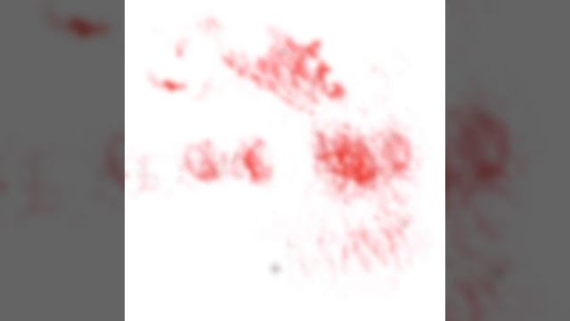 autoimmunity schema t-cells and skin cells