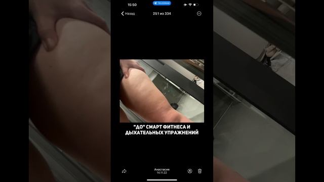 Как мне удалось добиться таких результатов рассказываю ПОДРОБНО в своем инст #целлюлит #тело #фитне