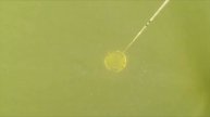 Using a plankton net to collect cyanobacteria samples | cyanoScope