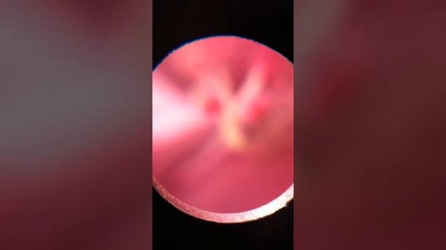 Hibiscus pollen