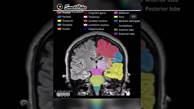 Skull and Brain 🧠🧠🧠 Anatomy