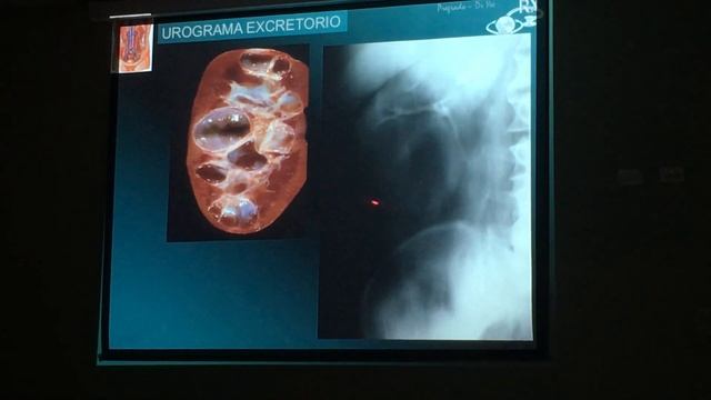 IMAGENOLOGIA UROGRAMA EXCRETORIO 2