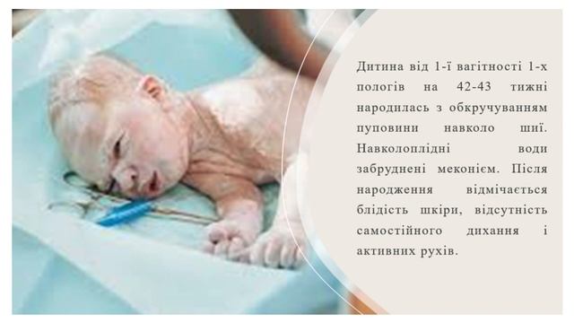Асфіксія новонароджених