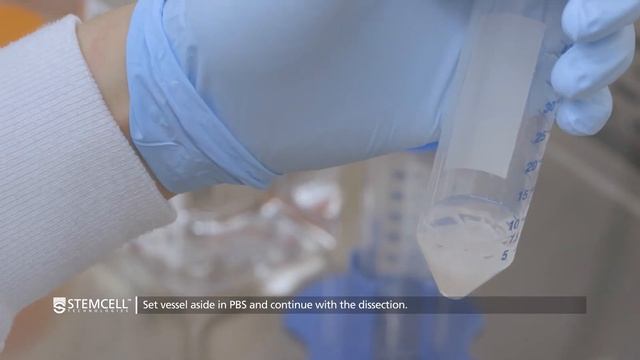 Isolation of Umbilical Cord Mesenchymal Stromal Cells Using Explant Method