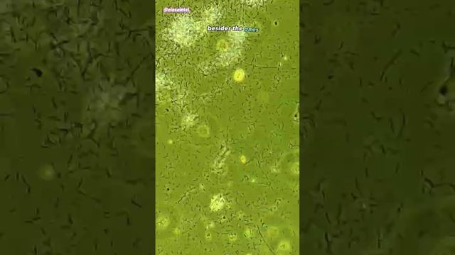 Colloidal Silver vs Germs Under Microscope