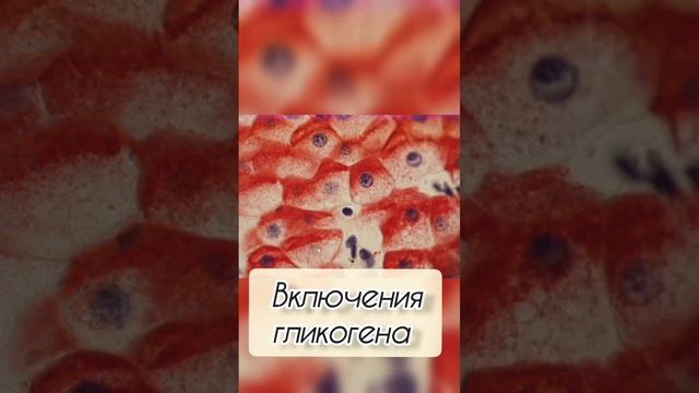 основное о гистопрепарате #включения гликогена