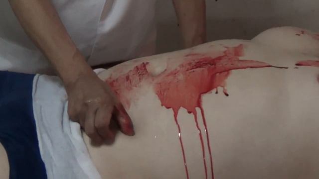 Джун Лаб за работой 11 ноября 2014 г Багио ( Jun Labo Psychic Surgery November 2014)