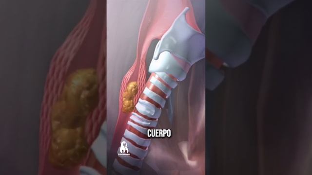 TIPOS DE TEJIDO MUSCULAR