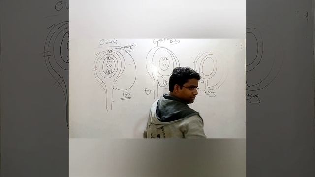 Types of ovule in plant #neet #botany