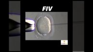 Etapas da FIV