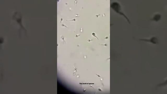 Sperms