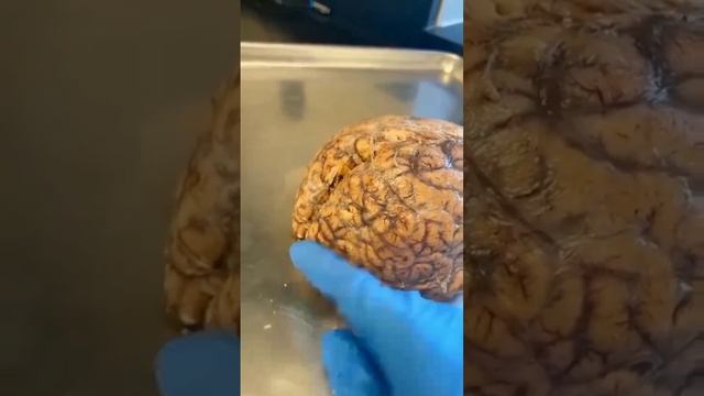 The Human Brain | Being Anatomy | Human Anatomy #anatomy #neet #mbbs #study #nda #aiims #amazing