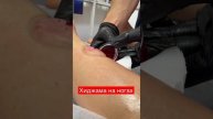 Хиджама для мужчин и женщин