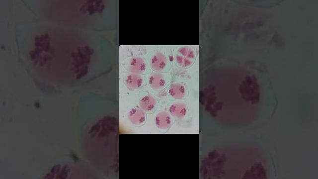 MEIOTIC CELL DIVISION STAGES OF Allium cepa L. (ONION)