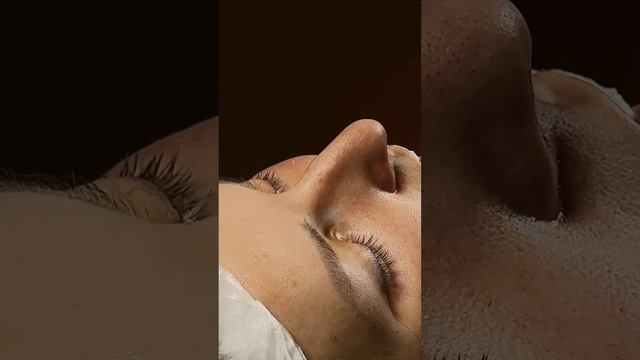 Риносептопластика.