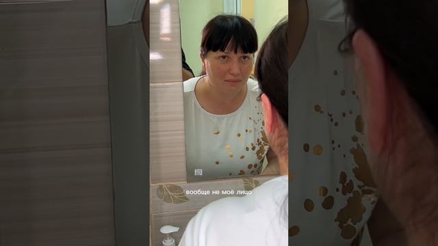 Ринопластика. Знакомство.