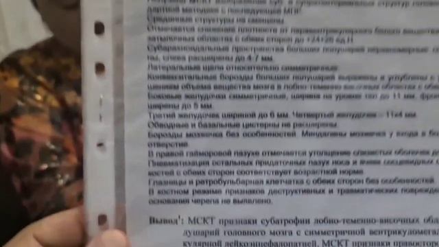 МИКРОЦЕФАЛИЯ. ОТСТАВАНИЕМ ПСИХОФИЗ ИЧЕСКОГО РАЗВИТИЯ