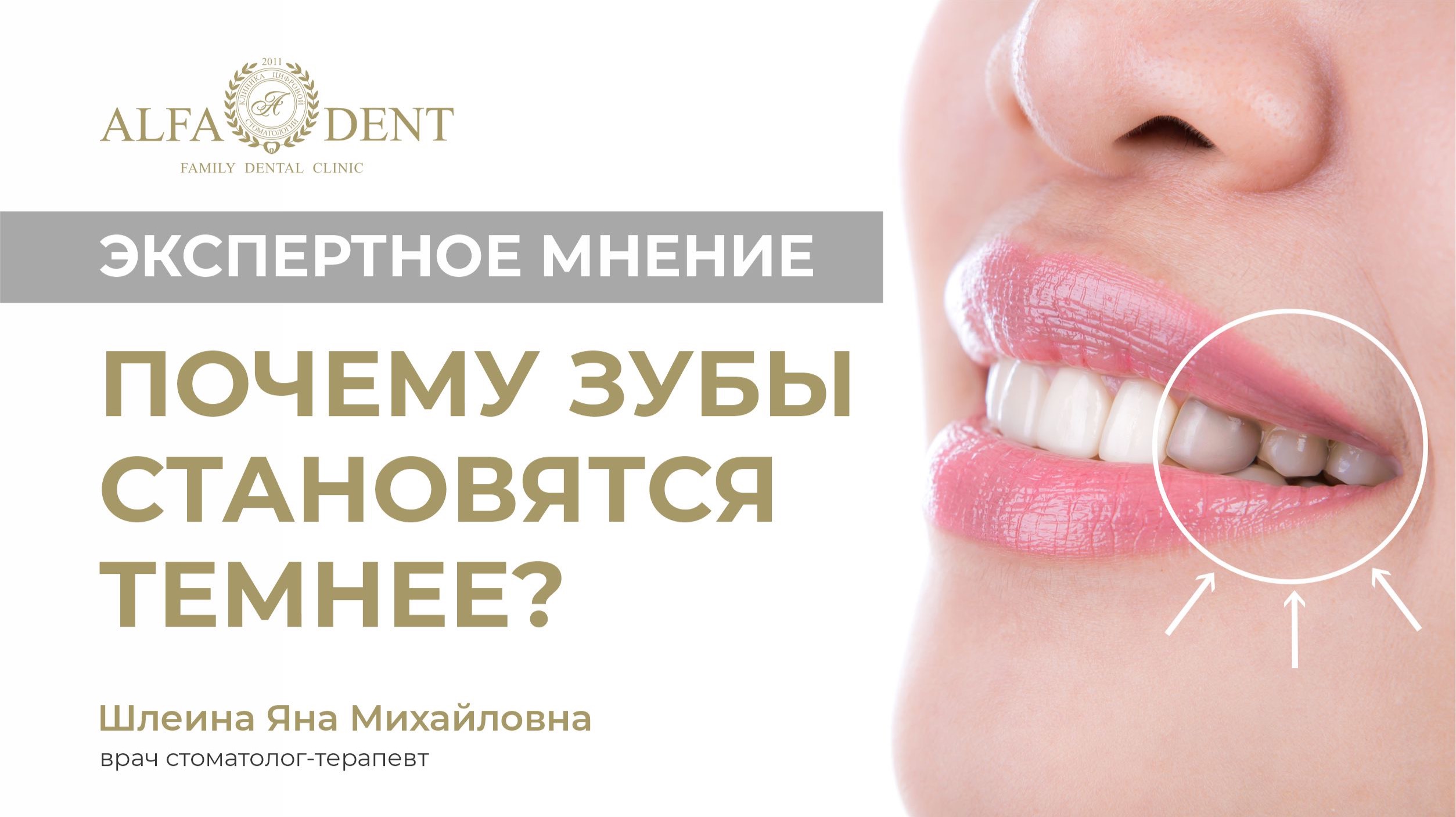 Почему зубы становятся темнее?