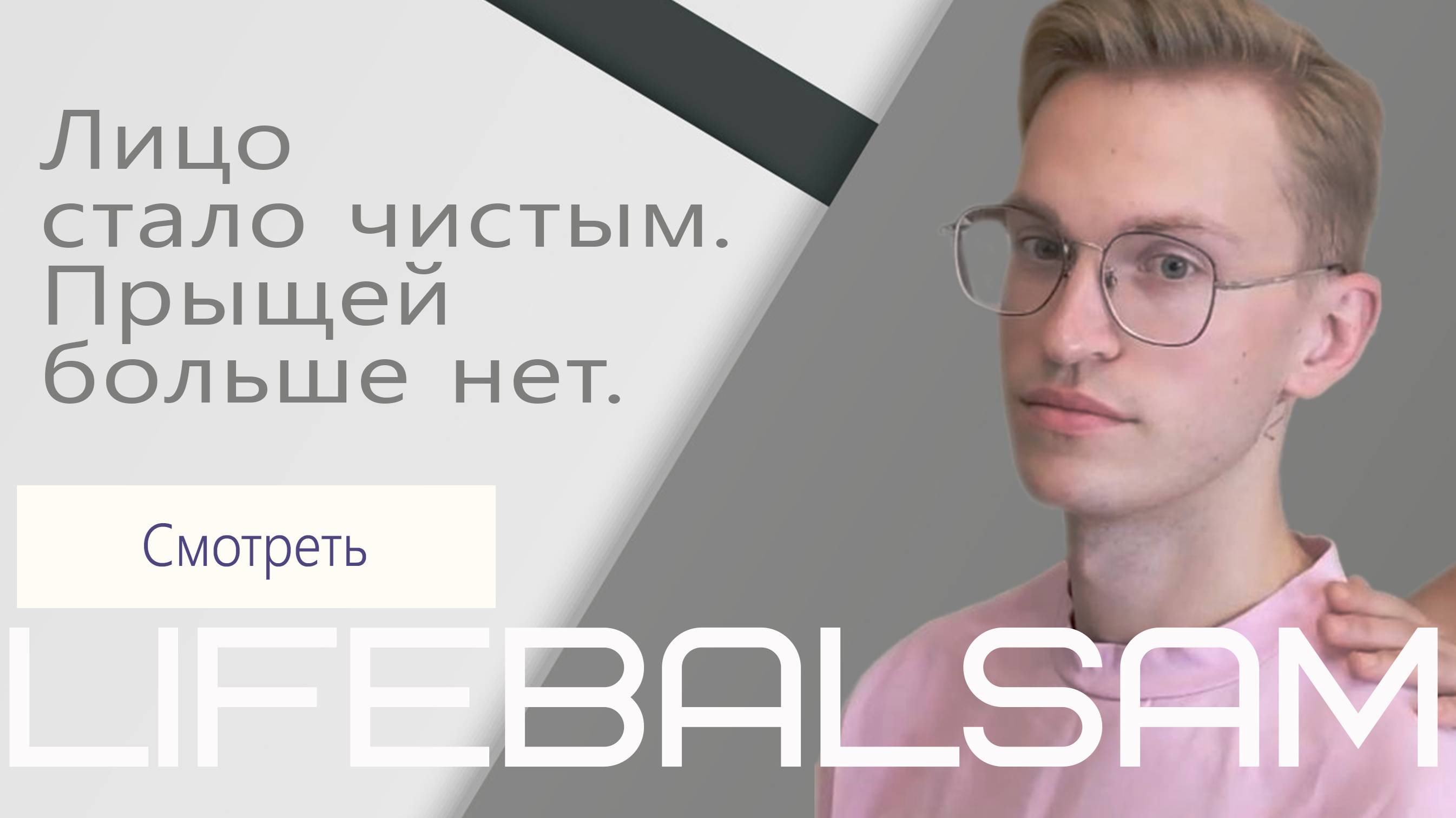 Лицо стало чистым. Прыщей больше нет.