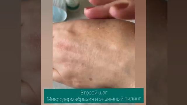 Набор Expert Active Renewal
