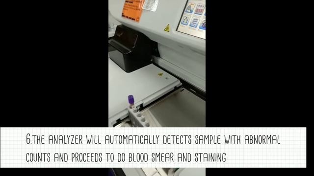 Full Blood Count (FBC) test using Sysmex XN-3000 (Automated Mode)