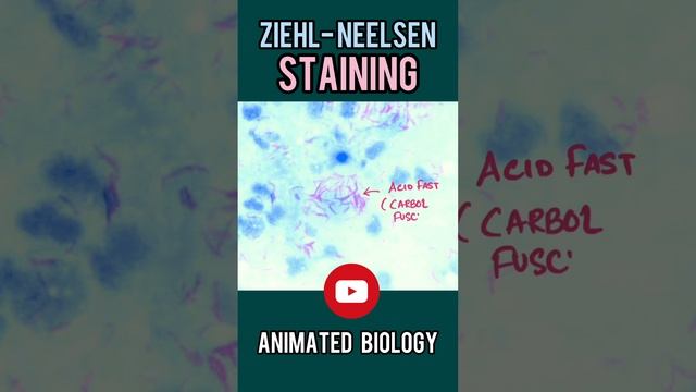 Ziehl-Neelsen (ZN) stain |  What we can identify using  ZN stain? | Microbio in 1 minute