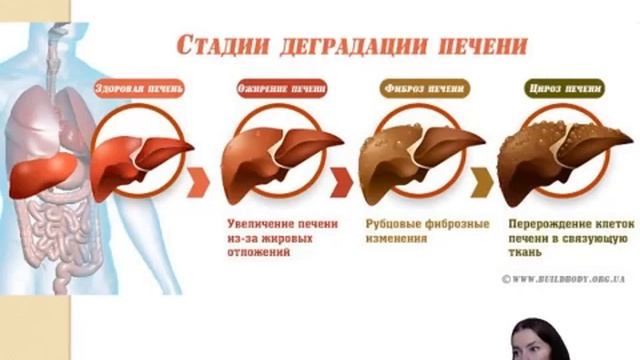 28 29 03 Лекция  Сахарная зависимость часть 2  Признаки инсулинорезистентности