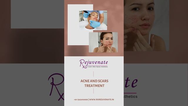 Best Aesthetic Clinic in Delhi NCR  (27)