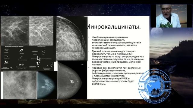 Mammography BI RADS МУСТАФИН ЧИНГИС 79104653497