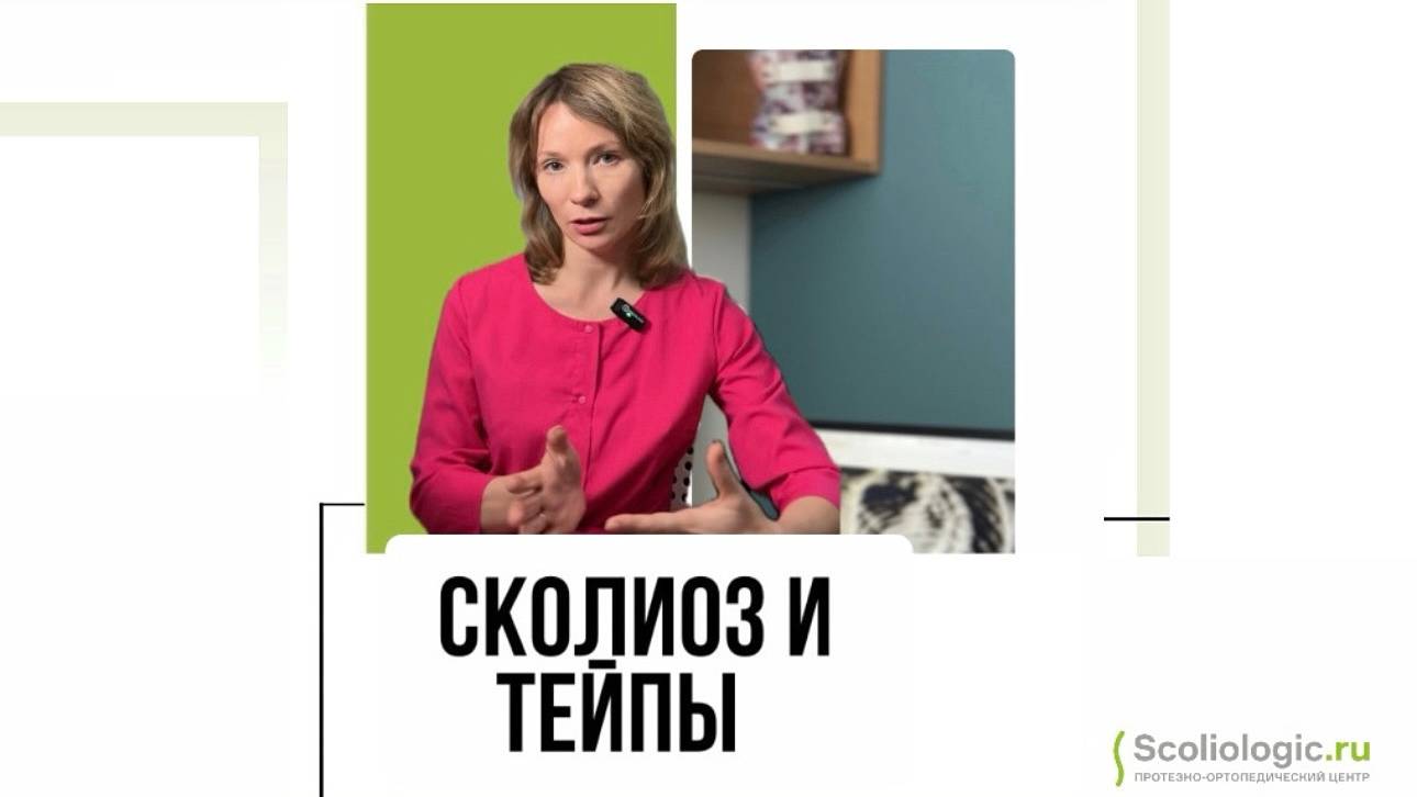 Тейпирование при сколиозе помогает?