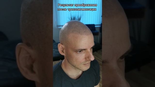 Как меняет ТРИХОПИГМЕНТАЦИЯ | SMPstudio.ru #scalpmicropigmentation #трихопигментация #татуволос