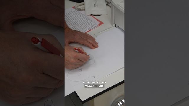 Органосохраняющая операция при раке молочной железы