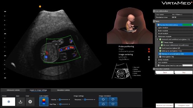 Симулятор для обучения гистероскопии VirtaMed Gynos Hysteroscopy. Разбор преимуществ