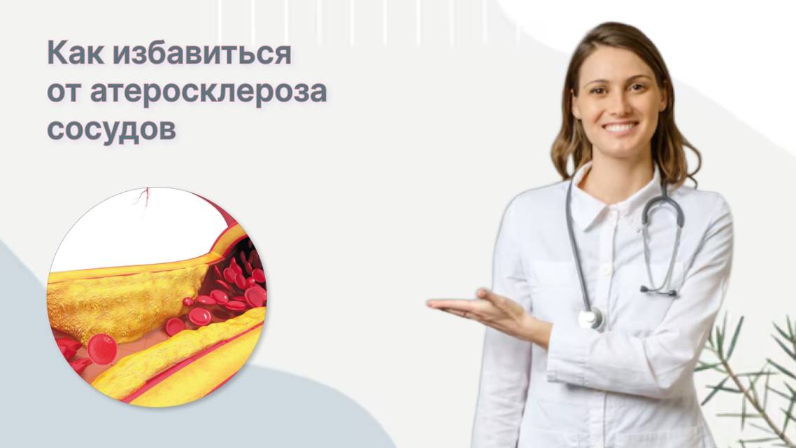 ВЕСТОР - Невейшее средство от бляшек в сосудах Сово Сова