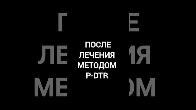 ВЫЛЕЧИЛИ АРТРОЗ ЗА 1 СЕАНС. Pdtr