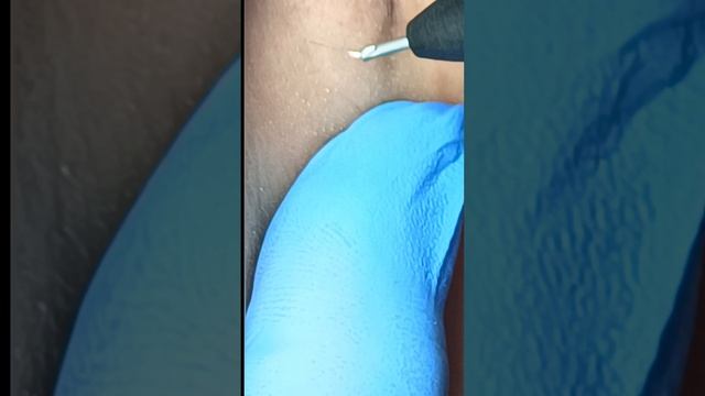 1000329893.mp4