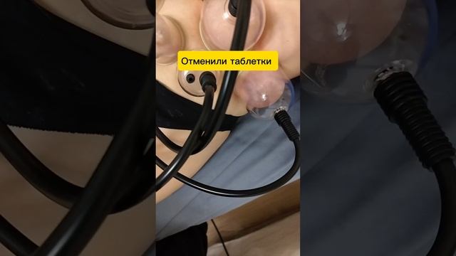 Похудела после сложной беременности на гормонах👌