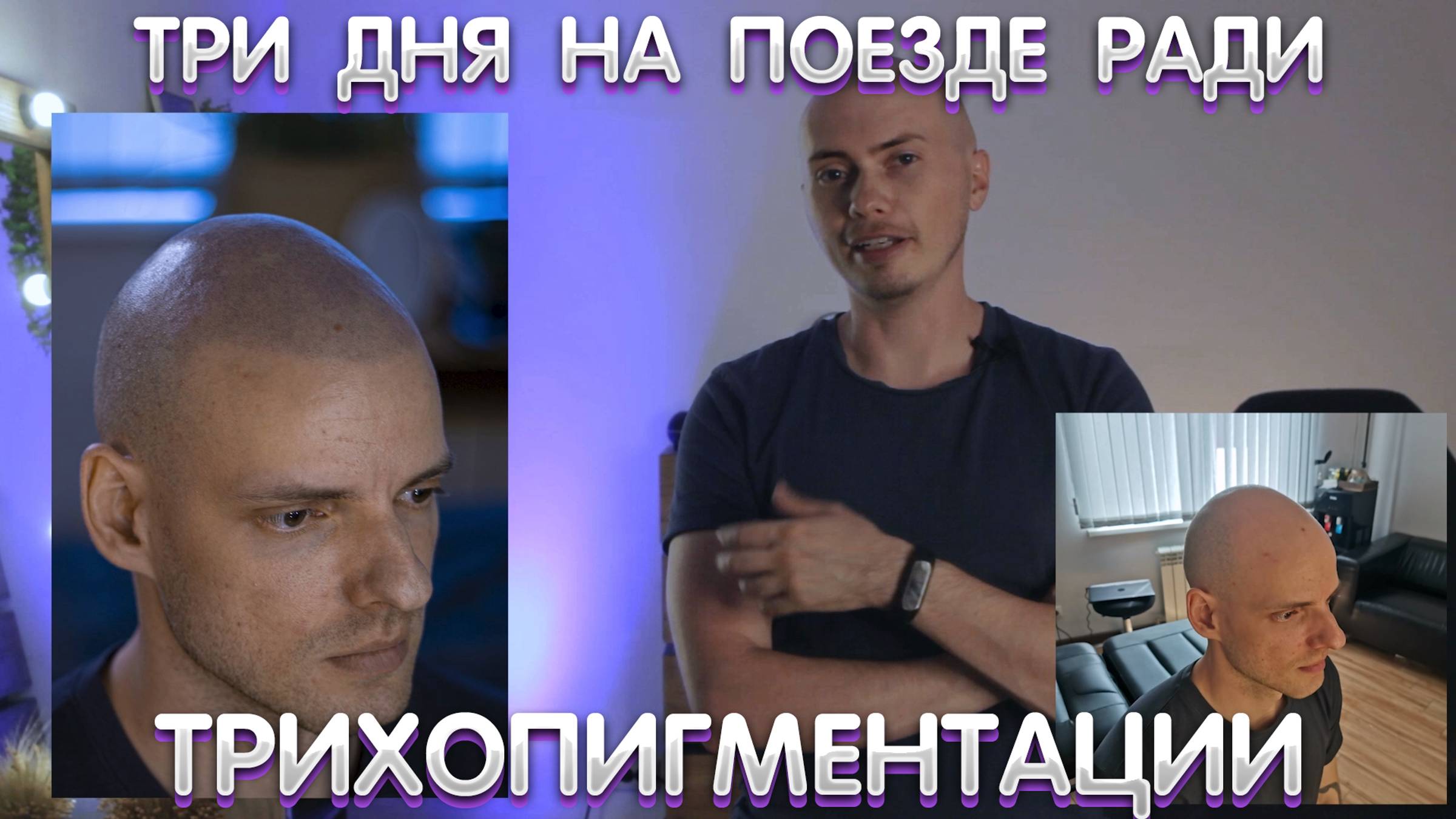 Из Тюмени в Краснодар за трихопигментацией