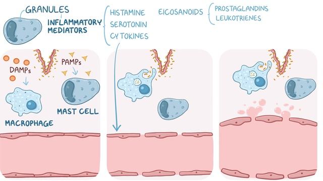 Inflammation - causes, symptoms, diagnosis, treatment, pathology