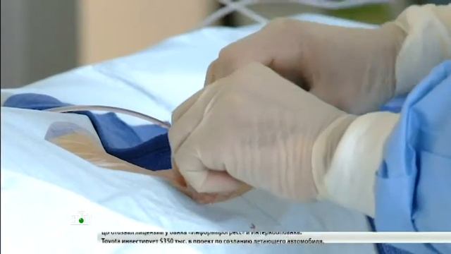Эндоваскулярное лечение аневризмы