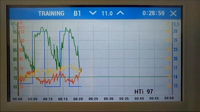 ГИПОКСИЧЕСКАЯ ТРЕНИРОВКА НА АППАРАТЕ _ЭВЕРЕСТ АНТ-01Е_