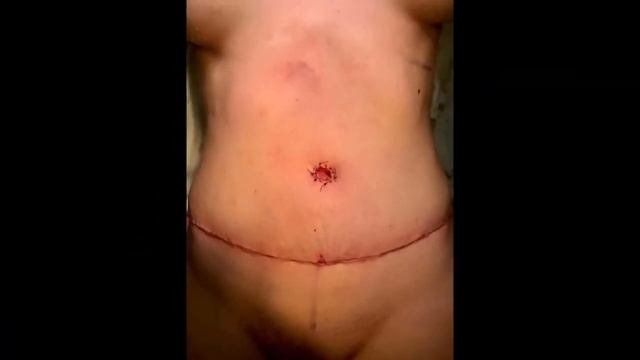 30. Представление клуба _Хирургия двух столиц_