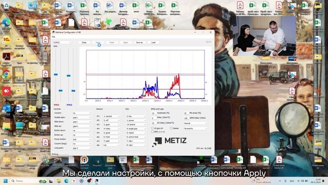 Поиск миопотенциалов на культе пациента